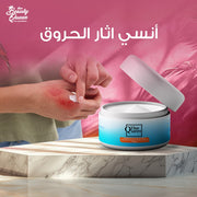 كوين لعلاج الحروق