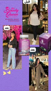 كبسولات كوين جيرل للتخسيس